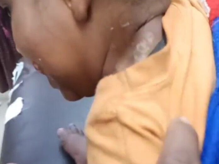 बहराइच में भेड़िए ने मासूम पर किया हमला: परिजनों के