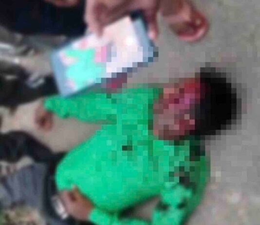 जमुई-पिपरिया नहर-पुलिया बनी-खूनी पुलिया’, बाइक सवार गंभीर रूप से घायल:निचलौल -पुरैना मार्ग जमुई-पिपरिया नहर पुलिया बनी ‘खूनी पुलिया’, बाइक सवार गंभीर रूप से घायल