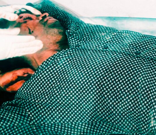 मल्हीपुर में दो बाइकों में भिड़ंत:हादसे में दोनों चालक घायल, अस्पताल में भर्ती