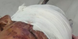 अज्ञात वाहन की टक्कर से बाइक सवार हुआ घायल:गोरखपुर के बीआरडी मेडिकल कॉलेज रेफर, हालत गंभीर