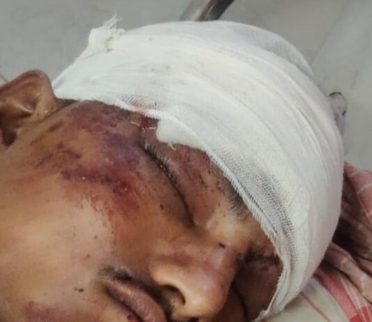 अज्ञात वाहन की टक्कर से बाइक सवार हुआ घायल:गोरखपुर के बीआरडी मेडिकल कॉलेज रेफर, हालत गंभीर