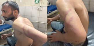 आगरा में इंस्टाग्राम दोस्ती का “ग्रामीण पंचायत संस्करण”: मिलने पहुंचे युवक की पिटाई, पेड़ से बांधने का आरोप