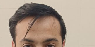 महाराजगंज अस्पताल में डिहाइड्रेशन के मरीज बढ़े:डॉक्टर अनस ने बचाव के लिए सलाह दी, छाछ और नारियल पानी के सेवन की सलाह दी