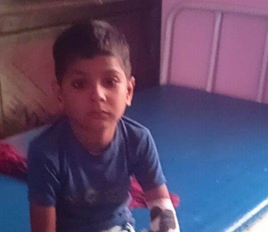 इकौना में बंदर का हमला, मासूम बच्चा घायल:सामुदायिक स्वास्थ्य केंद्र में भर्ती, हालत खतरे से बाहर