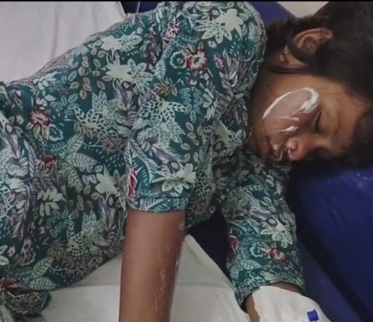 श्रावस्ती में गैस रिसाव से लगी थी आग:मूकबधिर पिता समेत तीन बच्चे झुलसे, हालत गंभीर, बहराइच इलाज के बाद लखनऊ रेफर