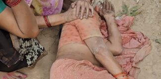 बस्ती में जमीन विवाद में खूनी संघर्ष, दो गंभीर घायल:एक ही परिवार के पांच लोगों पर धारदार हथियार से हमला, मुकदमा दर्ज