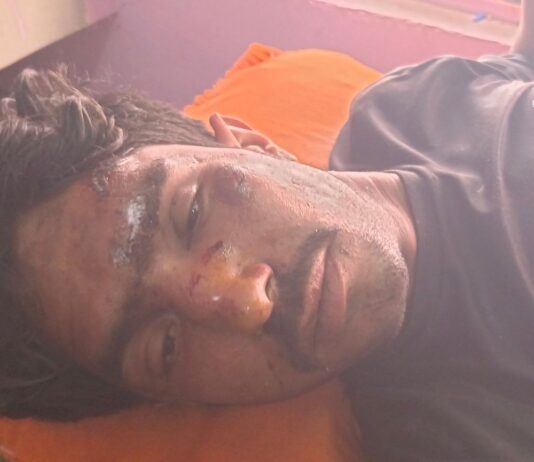 मल्हीपुर में तेज रफ्तार बाइक ने युवक को मारी टक्कर:गंभीर घायल, अस्पताल में भर्ती कराया गया