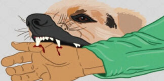 अजमेर: गली के कुत्ते ने डेढ़ महीने के मासूम को नोचा, आंतें आईं बाहर