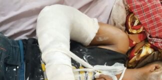 गिलौला में मोबाइल गेम खेलते समय युवक छत से गिरा:दोनों हाथों में फ्रैक्चर, बहराइच अस्पताल में भर्ती