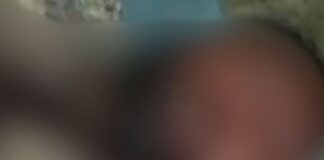 महराजगंज में पुरानी रंजिश में युवक पर हमला:गंभीर हालत में गोरखपुर मेडिकल कॉलेज रेफर