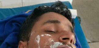 बढ़नी में ट्रांसफार्मर से झुलसा व्यक्ति:सभासद की सूचना पर विभाग ने लगाई अस्थाई बैरिकेडिंग