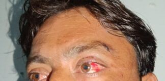 शोहरतगढ़ में युवक से मारपीट, थाने पहुंचा मामला:वैवाहिक विवाद में बीच-बचाव करने पर आधा दर्जन पर आरोप