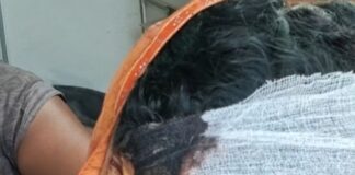 कतर्नियाघाट में तेंदुए के हमले में तीन घायल:तेलियनपुरवा गांव में मां ने बच्चे को बचाने के लिए संघर्ष किया
