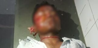 कुत्ता आने से बाइक गिरी, युवक गंभीर घायल:सामुदायिक स्वास्थ्य केंद्र से जिला अस्पताल रेफर