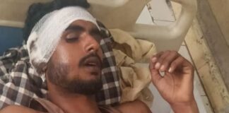 पिकअप चालक दो भाई मारपीट में घायल:जिला अस्पताल में चल रहा इलाज, पुलिस जांच में जुटी