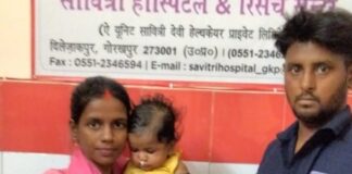 बस्ती में आरबीएसके टीम बनकटी ने जोड़ा कटे होठ:साढ़े तीन माह की बच्ची का सफल ऑपरेशन
