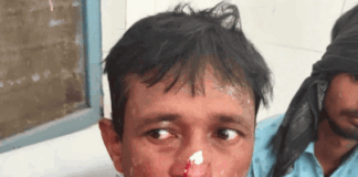 मधवापुर में मछलीमंडी का शटरिंग गिरा, एक मजदूर की मौत:पांच घायल, जिलाधिकारी; पुलिस अधीक्षक मौके पर पहुंचे