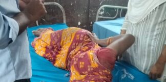 रामपुर धोबिया हार में बाइक ने महिला को मारी टक्कर:महिला गंभीर रूप से घायल, निजी अस्पताल में भर्ती