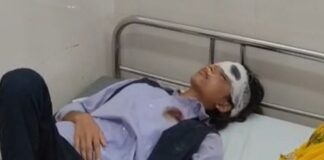 स्कूटी अनियंत्रित होने से युवती घायल:महराजगंज के शिवनगर में दुर्घटना, जिला अस्पताल में इलाज जारी