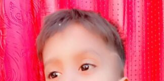 चार वर्षीय बालक को सांप ने काटा:खेलते समय हुई घटना, हालत गंभीर होने पर महराजगंज रेफर