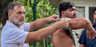 किसने कहने पर चली पैलेट गन, कितनी गोलियां चलीं? सबका हो गया खुलासा