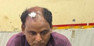 सिगरेट का धुआं फूंकने पर दो पक्षों में विवाद:जद्दूपिपरा गांव में मारपीट, एक घायल; पुलिस बल तैनात